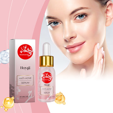 Hoygi Nicotinamide Anti Acne Serum Moisturizing Repair Serum with Hyaluronic Acid and Aloe Vera Extract